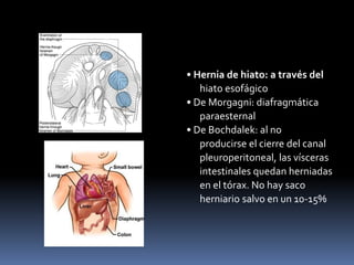 • Hernia de hiato: a través del
hiato esofágico
• De Morgagni: diafragmática
paraesternal
• De Bochdalek: al no
producirse el cierre del canal
pleuroperitoneal, las vísceras
intestinales quedan herniadas
en el tórax. No hay saco
herniario salvo en un 10-15%
 