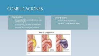 COMPLICACIONES
 Incarceración:
 Incapacidad del contenido volver a su
cavidad original
 dolor severo y un bulto no reducible
 síntomas de obstrucción intestinal.
 Estrangulación:
 Primero estar incarcerado.
 Isquemia y la muerte del tejido.
 