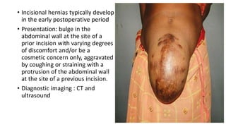 • Incisional hernias typically develop
in the early postoperative period
• Presentation: bulge in the
abdominal wall at the site of a
prior incision with varying degrees
of discomfort and/or be a
cosmetic concern only, aggravated
by coughing or straining with a
protrusion of the abdominal wall
at the site of a previous incision.
• Diagnostic imaging : CT and
ultrasound
 