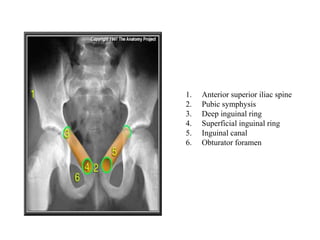 1. Anterior superior iliac spine
2. Pubic symphysis
3. Deep inguinal ring
4. Superficial inguinal ring
5. Inguinal canal
6. Obturator foramen
 