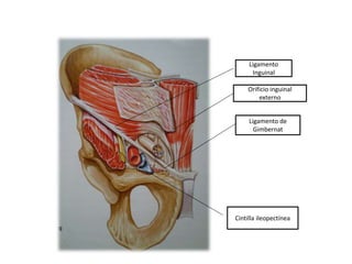 Ligamento
Inguinal
Orificio inguinal
externo
Ligamento de
Gimbernat
Cintilla ileopectínea
 