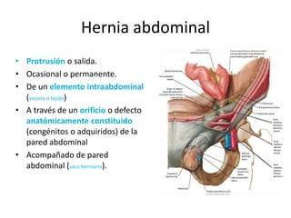Hernia abdominal
• Protrusión o salida.
• Ocasional o permanente.
• De un elemento intraabdominal
(viscera o tejido)
• A través de un orificio o defecto
anatómicamente constituido
(congénitos o adquiridos) de la
pared abdominal
• Acompañado de pared
abdominal (saco herniario).
 