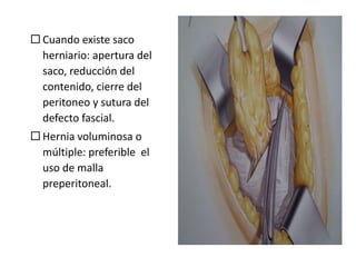  Cuando existe saco
herniario: apertura del
saco, reducción del
contenido, cierre del
peritoneo y sutura del
defecto fascial.
 Hernia voluminosa o
múltiple: preferible el
uso de malla
preperitoneal.
 