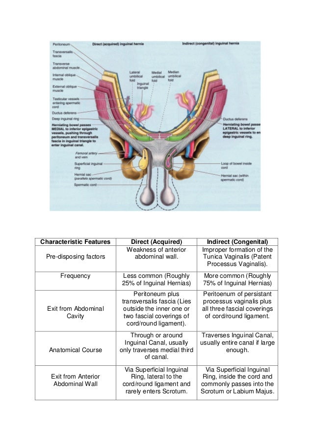 Hernia's and Groin Swellings