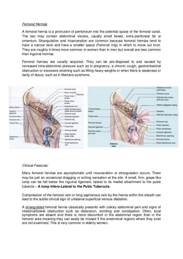 Hernia's and Groin Swellings