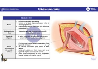 Mcvay Incision Comprehensive Overview of Abdominal Wall Hernias: Anatomy ...