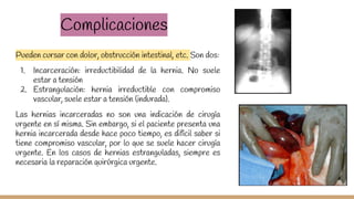 Complicaciones
Pueden cursar con dolor, obstrucción intestinal, etc. Son dos:
1. Incarceración: irreductibilidad de la hernia. No suele
estar a tensión
2. Estrangulación: hernia irreductible con compromiso
vascular, suele estar a tensión (indurada).
Las hernias incarceradas no son una indicación de cirugía
urgente en sí misma. Sin embargo, si el paciente presenta una
hernia incarcerada desde hace poco tiempo, es difícil saber si
tiene compromiso vascular, por lo que se suele hacer cirugía
urgente. En los casos de hernias estranguladas, siempre es
necesaria la reparación quirúrgica urgente.
 