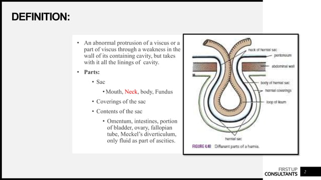 Herniated Definition Medical Dictionary Hernias definition, types, surgical anatomy of inguinal hernia | PPT