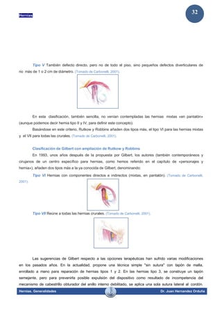 Hernias
Hernias. Generalidades Dr. Juan Hernandez Orduña
32
Tipo V También defecto directo, pero no de todo el piso, sino pequeños defectos diverticulares de
no más de 1 o 2 cm de diámetro. (Tomado de Carbonelli, 2001).
En esta clasificación, también sencilla, no venían contempladas las hernias mixtas «en pantalón»
(aunque podemos decir hernia tipo II y IV, para definir este concepto).
Basándose en este criterio, Rutkow y Robbins añaden dos tipos más, el tipo VI para las hernias mixtas
y el VII para todas las crurales. (Tomado de Carbonelli, 2001).
Clasificación de Gilbert con ampliación de Rutkow y Robbins
En 1993, unos años después de la propuesta por Gilbert, los autores (también contemporáneos y
cirujanos de un centro específico para hernias, como hemos referido en el capítulo de «personajes y
hernia»), añaden dos tipos más a la ya conocida de Gilbert, denominando:
Tipo VI Hernias con componentes directos e indirectos (mixtas, en pantalón). (Tomado de Carbonelli,
2001).
Tipo VII Reúne a todas las hernias crurales. (Tomado de Carbonelli, 2001).
Las sugerencias de Gilbert respecto a las opciones terapéuticas han sufrido varias modificaciones
en los pasados años. En la actualidad, propone una técnica simple "sin sutura" con tapón de malla,
enrollado a mano para reparación de hernias tipos 1 y 2. En las hernias tipo 3, se construye un tapón
semejante, pero para prevenirla posible expulsión del dispositivo como resultado de incompetencia del
mecanismo de cabestrillo obturador del anillo interno debilitado, se aplica una sola sutura lateral al cordón.
 