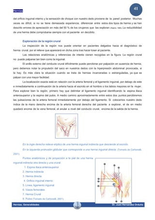 Hernias
Hernias. Generalidades Dr. Juan Hernandez Orduña
41
del orificio inguinal interno y la sensación de choque con nuestro dedo proviene de la pared posterior. Muchas
veces es difícil, si no se tiene demasiada experiencia, diferenciar entre estos dos tipos de hernia y se han
descrito errores de apreciación en más del 50 % de los cirujanos que las exploran (Ralphs 1980). La reductibilidad
de una hernia debe comprobarse siempre con el paciente en decúbito.
Exploración de la región crural
La inspección de la región nos puede orientar en pacientes delgados hacia el diagnóstico de
hernia crural, por el relieve que aparecerá en dicha zona tras hacer toser al paciente.
Las relaciones anatómicas y referencias de interés vienen recogidas en la figura. La región crural
no puede palparse tan bien como la inguinal.
El anillo externo del conducto crural difícilmente puede percibirse por palpación en ausencia de hernia,
pero debemos notar la propulsión del saco en nuestros dedos con la hiperpresión abdominal provocada, si
la hay. Es más clara la situación cuando se trata de hernias incarceradas o estranguladas, ya que se
palpan con una mayor facilidad.
La localización exacta está en relación con la arteria femoral y el ligamento inguinal, por debajo de este
e inmediatamente a continuación de la arteria hacia el escroto en el hombre o los labios mayores en la mujer.
Para explorar bien la región, primero hay que delimitar el ligamento inguinal identificando la espina iliaca
anterosuperior y la espina del pubis. A medio camino aproximadamente entre estos dos puntos percibiremos
las pulsaciones de la arteria femoral inmediatamente por debajo del ligamento. Si colocamos nuestro dedo
índice de la mano derecha encima de la arteria femoral derecha del paciente a explorar, el de en medio
quedará encima de la vena femoral, el anular a nivel del conducto crural, encima de la salida de la hernia.
En la ingle derecha relieve elíptico de una hernia inguinal indirecta que desciende al escroto.
En la izquierda protrusión globular que corresponde a una hernia inguinal directa. (Tomado de Carbonelli,
2001).
Puntos anatómicos y de proyección a la piel de una hernia
inguinal indirecta otra directa y una crural.
1. Espina iliaca anterosuperior
2. Hernia indirecta
3. Hernia directa
4. Orificio inguinal interno
5. Línea, ligamento inguinal
6. Vasos femorales
7. Hernia Crural
8. Pubis (Tomado de Carbonelli, 2001).
 