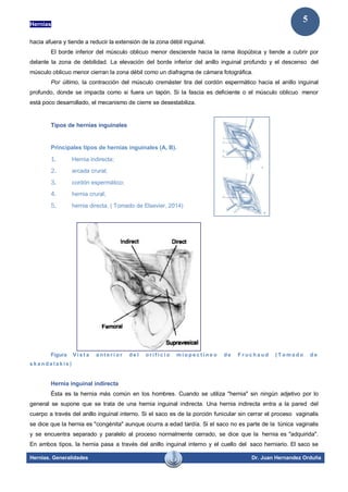Hernias
Hernias. Generalidades Dr. Juan Hernandez Orduña
5
hacia afuera y tiende a reducir la extensión de la zona débil inguinal.
El borde inferior del músculo oblicuo menor desciende hacia la rama iliopúbica y tiende a cubrir por
delante la zona de debilidad. La elevación del borde inferior del anillo inguinal profundo y el descenso del
músculo oblicuo menor cierran la zona débil como un diafragma de cámara fotográfica.
Por último, la contracción del músculo cremáster tira del cordón espermático hacia el anillo inguinal
profundo, donde se impacta como si fuera un tapón. Si la fascia es deficiente o el músculo oblicuo menor
está poco desarrollado, el mecanismo de cierre se desestabiliza.
Tipos de hernias inguinales
Principales tipos de hernias inguinales (A, B).
1. Hernia indirecta;
2. arcada crural;
3. cordón espermático;
4. hernia crural;
5. hernia directa. ( Tomado de Elsevier, 2014)
Figura V i s t a a n t e r i o r d e l o r i f i c i o m i o p e c t i n e o d e F r u c h a u d ( T o m a d o d e
s k a n d a l a k i s )
Hernia inguinal indirecta
Ésta es la hernia más común en los hombres. Cuando se utiliza "hernia" sin ningún adjetivo por lo
general se supone que se trata de una hernia inguinal indirecta. Una hernia indirecta entra a la pared del
cuerpo a través del anillo inguinal interno. Si el saco es de la porción funicular sin cerrar el proceso vaginalis
se dice que la hernia es "congénita" aunque ocurra a edad tardía. Si el saco no es parte de la túnica vaginalis
y se encuentra separado y paralelo al proceso normalmente cerrado, se dice que la hernia es "adquirida".
En ambos tipos, la hernia pasa a través del anillo inguinal interno y el cuello del saco herniario. El saco se
 