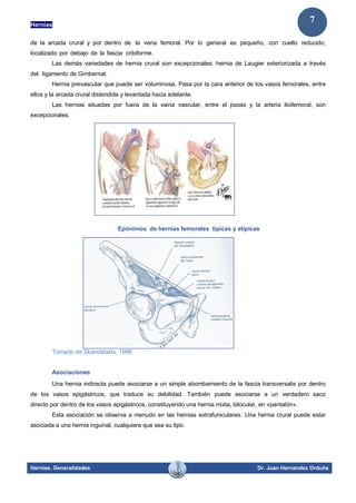 Hernias
Hernias. Generalidades Dr. Juan Hernandez Orduña
7
de la arcada crural y por dentro de la vena femoral. Por lo general es pequeño, con cuello reducido,
localizado por debajo de la fascia cribiforme.
Las demás variedades de hernia crural son excepcionales: hernia de Laugier exteriorizada a través
del ligamento de Gimbernat.
Hernia prevascular que puede ser voluminosa. Pasa por la cara anterior de los vasos femorales, entre
ellos y la arcada crural distendida y levantada hacia adelante.
Las hernias situadas por fuera de la vaina vascular, entre el psoas y la arteria iliofemoral, son
excepcionales.
Epónimos de hernias femorales típicas y atípicas
Tomado de Skandalakis, 1996
Asociaciones
Una hernia indirecta puede asociarse a un simple abombamiento de la fascia transversalis por dentro
de los vasos epigástricos, que traduce su debilidad. También puede asociarse a un verdadero saco
directo por dentro de los vasos epigástricos, constituyendo una hernia mixta, bilocular, en «pantalón».
Esta asociación se observa a menudo en las hernias extrafuniculares. Una hernia crural puede estar
asociada a una hernia inguinal, cualquiera que sea su tipo.
 