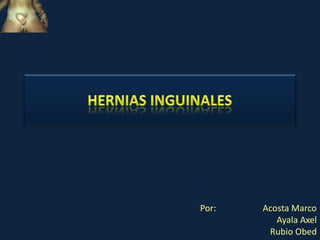 Hernias Inguinales Por:                     Acosta Marco Ayala Axel Rubio Obed 