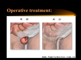 Operative treatment: 