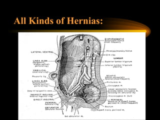 All Kinds of Hernias:   
