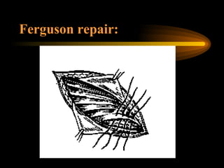Ferguson repair: 