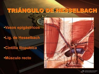 TRIÁNGULO DE HESSELBACH
•Vasos epigástricos
•Lig. de Hesselbach
•Cintilla iliopúbica
•Músculo recto
 