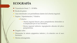 ECOGRAFÍA
 Transductor lineal 7 – 10 MHz
 Escala de grises:
 Asas intestinales con peristaltismo dentro de la hernia inguinal.
 Supino / bipedestación / Valsalva
Valsalva:
 Hernia inguinal directa: plexo pampiniforme distendido se
ve desplazado por el saco herniario.
 Hernia inguinal indirecta: ingurgitación alterada del plexo
pampiniforme.
 Doppler color:
 Demuestra la arteria epigástrica inferior y la relación con el saco
herniario.
 Hernia estrangulada.
 