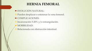 HERNIA FEMORAL
 EVOLUCIÓN NATURAL:
 Pueden desplazar o estenosar la vena femoral.
 COMPLICACIONES:
 Incarceración 5-20% y/o estrangulación.
 MORBILIDAD:
 Relacionada con obstrucción intestinal.
 