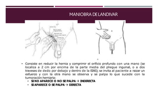 MANIOBRA DELANDIVAR
• Consiste en reducir la hernia y comprimir el orificio profundo con una mano (se
localiza a 2 cm por encima de la parte media del pliegue inguinal, o a dos
traveses de dedo por debajo y dentro de la EIAS); se invita al paciente a raizar un
esfuerzo y con la otra mano se observa y se palpa lo que sucede con la
tumoración herniaria:
• SINO APARECE O NO SE PALPA  INDIRECTA
• SIAPARECE O SE PALPA  DIRECTA
 