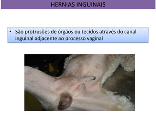 HERNIAS INGUINAIS
• São protrusões de órgãos ou tecidos através do canal
inguinal adjacente ao processo vaginal
 