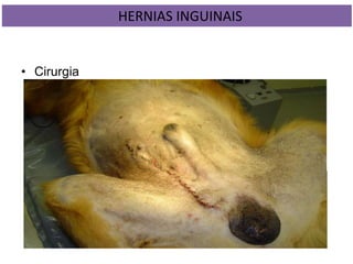 • Cirurgia
HERNIAS INGUINAIS
 