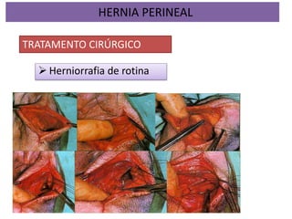  Herniorrafia de rotina
HERNIA PERINEAL
TRATAMENTO CIRÚRGICO
 