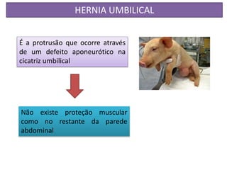 HERNIA UMBILICAL
É a protrusão que ocorre através
de um defeito aponeurótico na
cicatriz umbilical
Não existe proteção muscular
como no restante da parede
abdominal
 