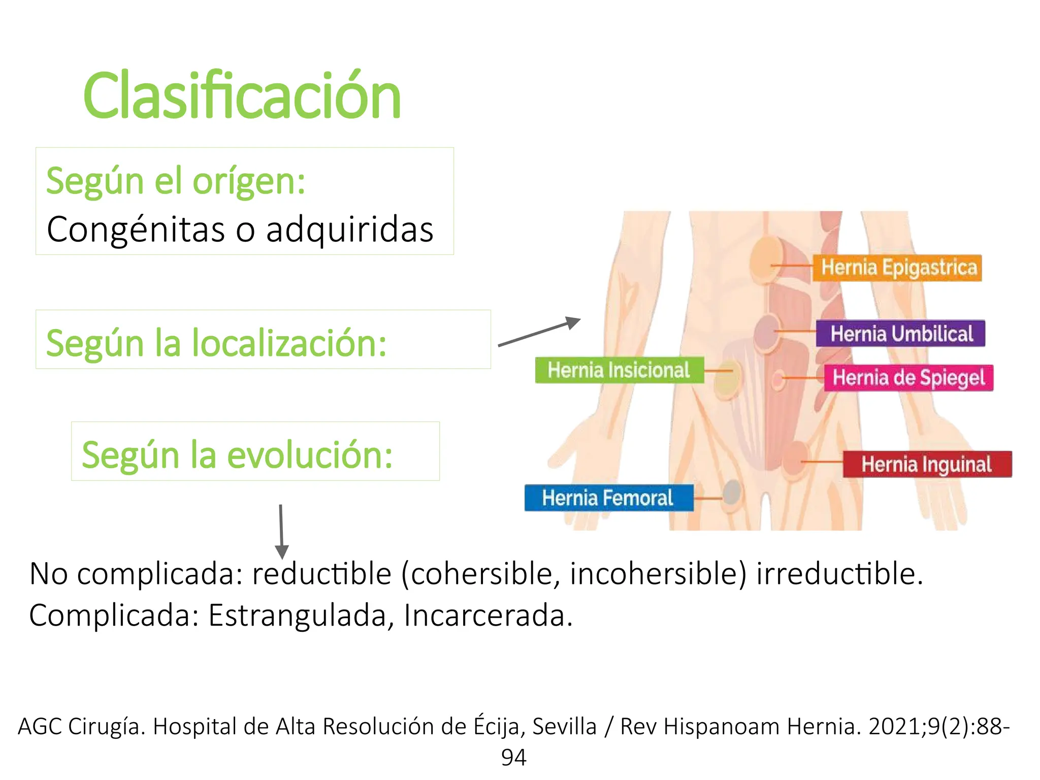 Clasificación
AGC Cirugía. Hospital de Alta Resolución de Écija, Sevilla / Rev Hispanoam Hernia. 2021;9(2):88-
94
Según el orígen:
Congénitas o adquiridas
Según la localización:
Según la evolución:
No complicada: reductible (cohersible, incohersible) irreductible.
Complicada: Estrangulada, Incarcerada.
 