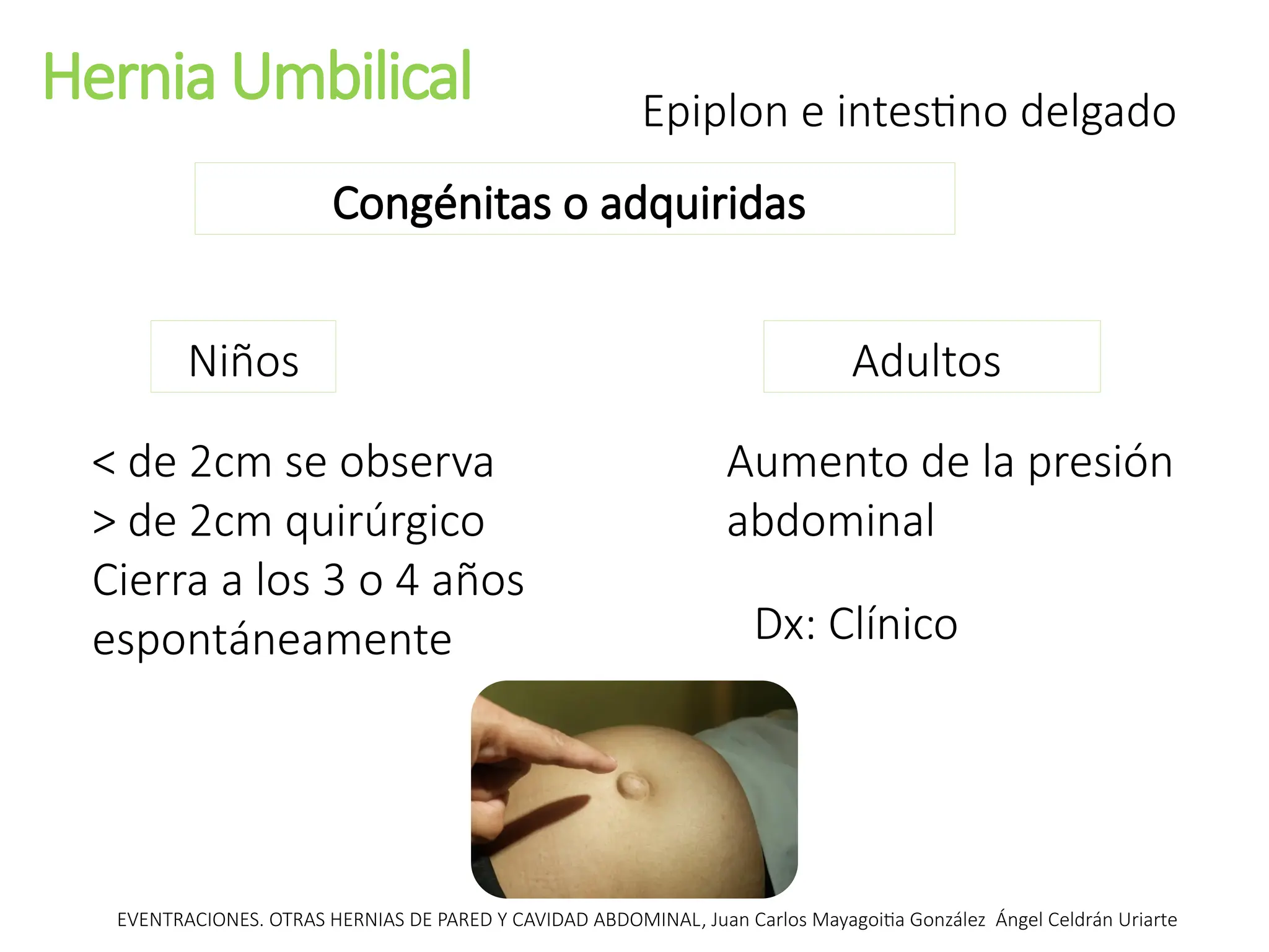 Hernia Umbilical
Congénitas o adquiridas
Niños Adultos
Epiplon e intestino delgado
< de 2cm se observa
> de 2cm quirúrgico
Cierra a los 3 o 4 años
espontáneamente
Aumento de la presión
abdominal
EVENTRACIONES. OTRAS HERNIAS DE PARED Y CAVIDAD ABDOMINAL, Juan Carlos Mayagoitia González Ángel Celdrán Uriarte
Dx: Clínico
 