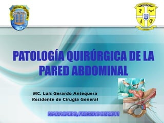 PATOLOGÍA QUIRÚRGICA DE LA
PARED ABDOMINAL
MC. Luís Gerardo Antequera
Residente de Cirugía General
 