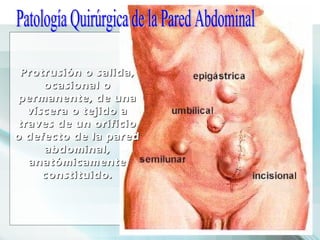 Patología Quirúrgica de Pared Abdominal