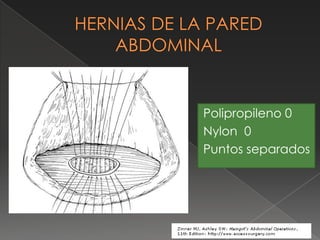 Polipropileno 0
Nylon 0
Puntos separados
 