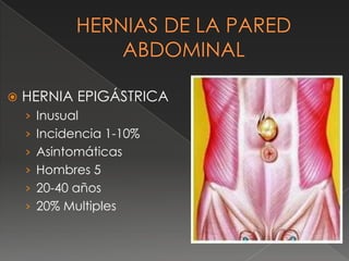  HERNIA EPIGÁSTRICA
› Inusual
› Incidencia 1-10%
› Asintomáticas
› Hombres 5
› 20-40 años
› 20% Multiples
 
