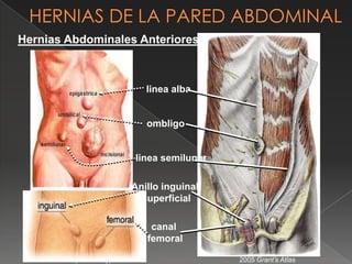 › Epigástricas
› Umbilicales
› Inguinales
› Crurales
› De Spiegel
› Lumbares
› Incisionales
Hernias Abdominales Anteriores
hernia.tripod.com/types.html 2005 Grant’s Atlas
linea alba
ombligo
linea semilunar
Anillo inguinal
superficial
canal
femoral
 