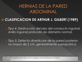  CLASIFICACION DE ARTHUR J. GILBERT (1989)
› Tipo 4: Destrucción del piso del conducto inguinal.
Anillo inguinal profundo de diámetro normal.
› Tipo 5: Defecto diverticular de la pared posterior
no mayor de 2 cm, generalmente suprapúbica.
Carbonell TF:clasificación.http://www.cirugest.com/revisiones/cir12-04/12-
04-04.pdf
 