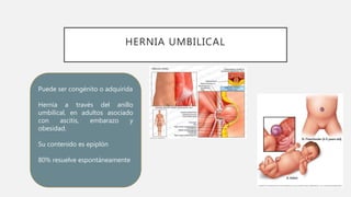 Hernias de la pared abdominal | PPTX