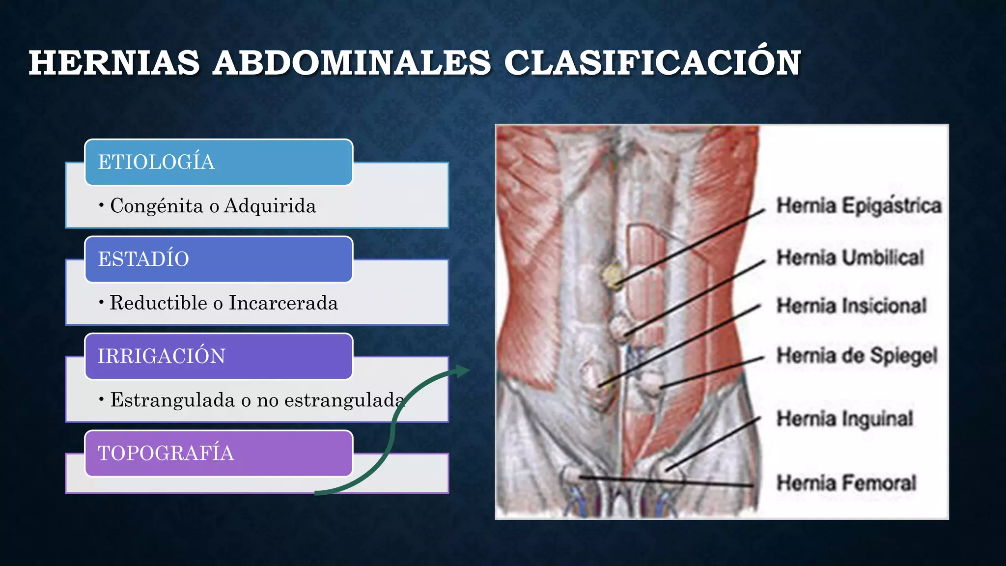 Hernias de la pared abdominal | PPT