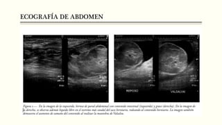 ECOGRAFÍA DE ABDOMEN
 