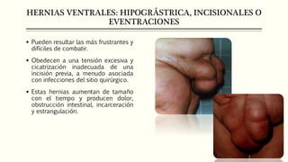 HERNIAS VENTRALES: HIPOGRÁSTRICA, INCISIONALES O
EVENTRACIONES
 Pueden resultar las más frustrantes y
difíciles de combatir.
 Obedecen a una tensión excesiva y
cicatrización inadecuada de una
incisión previa, a menudo asociada
con infecciones del sitio quirúrgico.
 Estas hernias aumentan de tamaño
con el tiempo y producen dolor,
obstrucción intestinal, incarceración
y estrangulación.
 