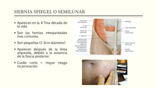 HERNIA SPIEGEL O SEMILUNAR
 Aparecen en la 4-7ma década de
la vida.
 Son las hernias interparietales
mas comunes.
 Son pequeñas (1-2cm diámetro)
 Aparecen después de la línea
arqueada, debido a la ausencia
de la fascia posterior.
 Cuello corto = mayor riesgo
incarceración
 