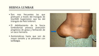 HERNIA LUMBAR
 Son mas frecuentes las que
protruyen a través del triangulo de
Grynfeltt (superiores), que las del
triangulo de Petit (inferior).
 El debilitamiento de la fascia
lumbodorsal provoca protrusión
progresiva de grasa y formación de
un saco herniario.
 Asintomáticas hasta que son de
mayor tamaño y se presentan con
lumbalgia.
 
