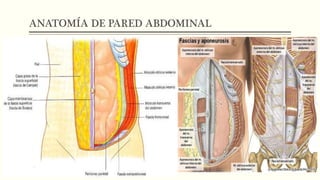 ANATOMÍA DE PARED ABDOMINAL
 