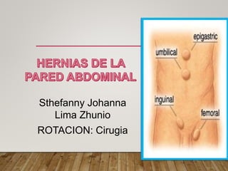 Sthefanny Johanna
Lima Zhunio
ROTACION: Cirugia
 