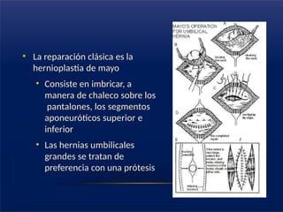 • La reparación clásica es la
hernioplastia de mayo
• Consiste en imbricar, a
manera de chaleco sobre los
pantalones, los segmentos
aponeuróticos superior e
inferior
• Las hernias umbilicales
grandes se tratan de
preferencia con una prótesis
 