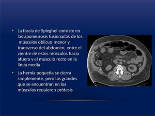 • La fascia de Spieghel consiste en
las aponeurosis fusionadas de los
músculos oblicuo menor y
transverso del abdomen, entre el
vientre de estos músculos hacia
afuera y el musculo recto en la
línea media
• La hernia pequeña se cierra
simplemente, pero las grandes
que se encuentran en los
músculos requieren prótesis
 