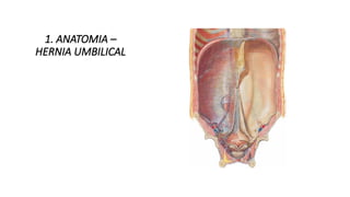 HERNIAS DE LA PARED ABDOMINAL ANTERIOR.pptx