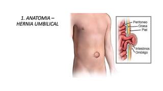 HERNIAS DE LA PARED ABDOMINAL ANTERIOR.pptx