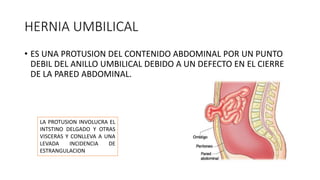 Hernias de la pared abdominal ppt karo | PPTX