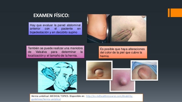 Si es posible adelgazar por medio del kiwi las revocaciones